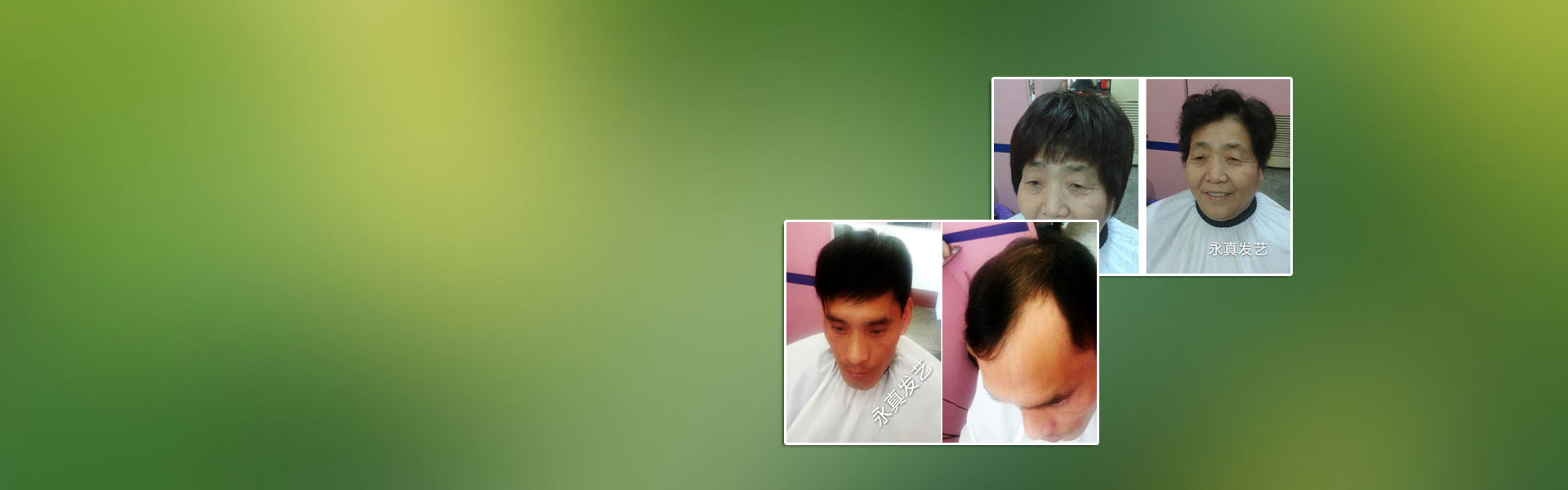 二十年织发补发经验 ——